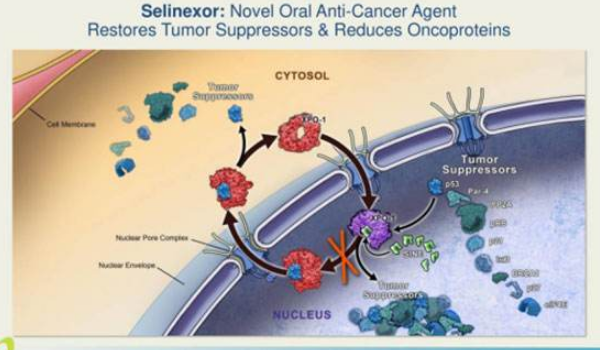 美国FDA加速批准Xpovio（Selincer）治疗复发或难治性多发性骨髓瘤患者